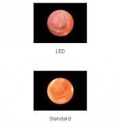 Otoskop LED RI-SCOPE L2 2.5V R-3708 RIESTER